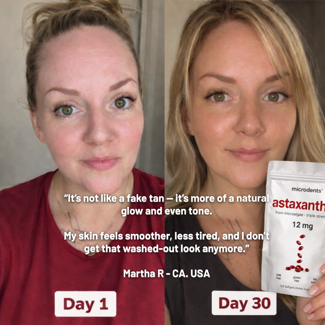 Microdents® - 10 in 1 Premium Astaxanthin Antioxidant 12mg